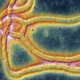 Illustration for article titled We now have a second Ebola patient in Dallas